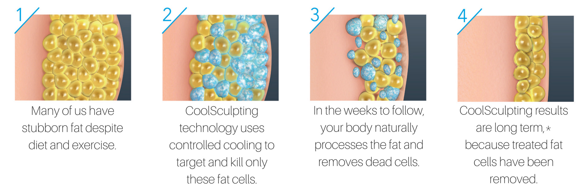 how-coolsculpting-works-web