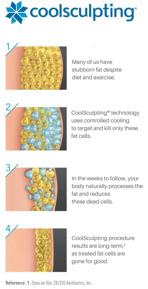 how-coolsculpting-works-mobile